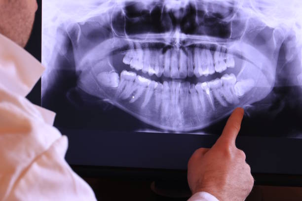 Best Emergency Tooth Extraction in Clinton, MI