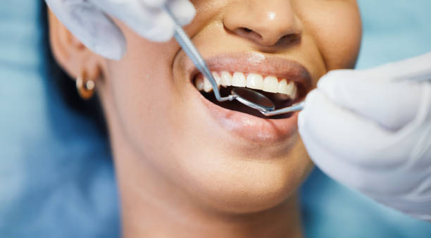 Best Emergency Denture Repair in Clinton, MI